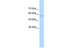 DDC antibody used at 5 ug/ml to detect target protein. (DDC antibody)