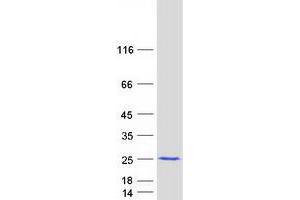 Western Blotting (WB) image for Methionine Sulfoxide Reductase B3 (MSRB3) (Transcript Variant 2) protein (Myc-DYKDDDDK Tag) (ABIN2726473)