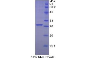 SDS-PAGE analysis of Chicken Transferrin Receptor Protein. (Transferrin Receptor Protein)