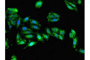 Immunofluorescent analysis of Hela cells using ABIN7149900 at dilution of 1:100 and Alexa Fluor 488-congugated AffiniPure Goat Anti-Rabbit IgG(H+L) (Dihydrofolate Reductase antibody  (AA 2-187))