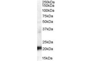 Western Blotting (WB) image for anti-Coiled-Coil Domain Containing 176 (CCDC176) (N-Term) antibody (ABIN2156539) (C14orf45 antibody  (N-Term))