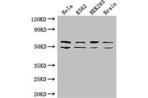 Western Blot Positive WB detected in: Hela whole cell lysate, K562 whole cell lysate, HEK293 whole cell lysate, Mouse brain tissue All lanes: IGF2BP3 antibody at 2 μg/mL Secondary Goat polyclonal to rabbit IgG at 1/50000 dilution Predicted band size: 64, 22 kDa Observed band size: 64, 50 kDa