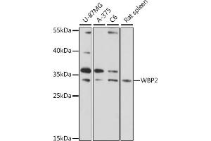 Western blot analysis of extracts of various cell lines, using WBP2 antibody (ABIN7271391) at 1:1000 dilution. (WBP2 antibody  (AA 15-140))