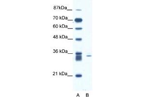 WB Suggested Anti-SIAH1 Antibody Titration:  1. (SIAH1 antibody  (N-Term))