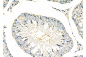 ABIN6265057 and ABIN6279818 at 1/100 staining Rat testis tissue by IHC-P.