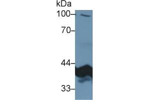 Western Blotting (WB) image for anti-Pyruvate Dehydrogenase beta (PDHB) (AA 31-341) antibody (ABIN7434347)