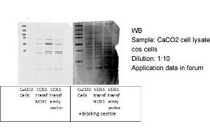 NOX1 antibody - C-terminal region  validated by WB using Epithelial Colorectal Adenocarcinoma CaCO2 at 1:10. (NOX1 antibody  (C-Term))