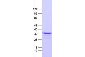 Validation with Western Blot