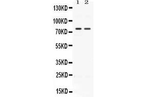 Western blot analysis of ACVR2A expression in rat kidney extract ( Lane 1) and HELA whole cell lysates ( Lane 2).