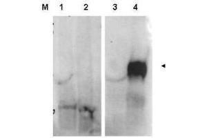 Western blot using  affinity purified anti-FAP antibody shows detection of FAP protein in whole cell lysates from FAP expressing HEK cells (lane 4) but not control HEK cells (lane 3).