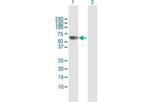 Western Blot analysis of IFIT1 expression in transfected 293T cell line by IFIT1 MaxPab polyclonal antibody. (IFIT1 antibody  (AA 1-478))