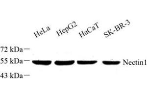 Western blot analysis of Nectin1 (ABIN7074789) at dilution of 1: 500 (Nectin-1 (NECTIN1) antibody)