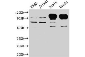 Western Blot Positive WB detected in: K562 whole cell lysate, Jurkat whole cell lysate, Rat brain tissue, Mouse brain tissue All lanes: MAG antibody at 5 μg/mL Secondary Goat polyclonal to rabbit IgG at 1/50000 dilution Predicted band size: 70, 64, 67 kDa Observed band size: 70, 100 kDa (MAG antibody  (AA 25-516))