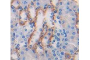 Figure. (Resistin antibody  (AA 21-114))