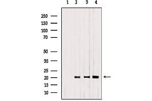 Western blot analysis of extracts from 293，B16F10，Mouse myeloma, using CNPY2,MSAP antibody. (CNPY2/MSAP antibody  (C-Term))