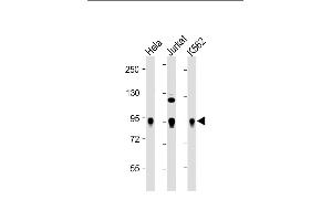 All lanes : Anti-Wee1 Antibody at 1:2000 dilution Lane 1: Hela whole cell lysate Lane 2: Jurkat whole cell lysate Lane 3: K562 whole cell lysate Lysates/proteins at 20 μg per lane. (WEE1 antibody  (Ser123))