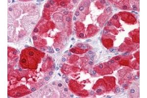 Immunohistochemistry (IHC) image for anti-Crystallin, mu (CRYM) (AA 215-315) antibody (ABIN614593) (CRYM antibody  (AA 215-315))