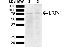 Western blot analysis of Mouse, Rat Brain showing detection of 504. (LRP1 antibody  (AA 160-260) (Atto 594))