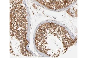 ABIN6266459 at 1/200 staining human testis tissue sections by IHC-P. (FER antibody  (pTyr402))