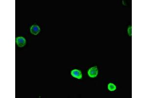 Immunofluorescent analysis of HepG2 cells using ABIN7171466 at dilution of 1:100 and Alexa Fluor 488-congugated AffiniPure Goat Anti-Rabbit IgG(H+L) (TSNARE1 antibody  (AA 6-339))