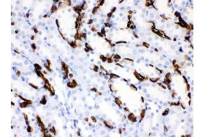 Band 3/AE1 antibody  (AA 28-365)