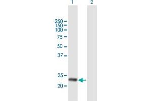 Western Blot analysis of DNAJC30 expression in transfected 293T cell line by DNAJC30 MaxPab polyclonal antibody. (DNAJC30 antibody  (AA 1-226))