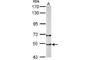 WB Image Sample (50 ug of whole cell lysate) A: Mouse brain 7. (CCT2 antibody)