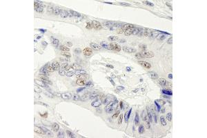 Immunohistochemistry (IHC) image for anti-Symplekin (SYMPK) (AA 1224-1274) antibody (ABIN7448822)