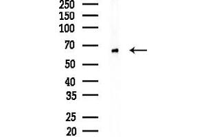 anti-DCP2 Decapping Enzyme Homolog (DCP2) (Internal Region) antibody