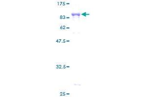 YARS Protein (AA 1-528) (GST tag)