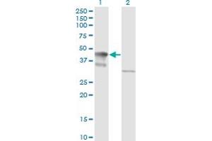 Western Blot analysis of MAPK3 expression in transfected 293T cell line by MAPK3 monoclonal antibody (M05), clone 3D6. (ERK1 antibody  (AA 279-379))