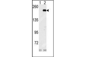 Western blot analysis of GCN2 (arrow) using GCN2 Antibody (GCN2 antibody  (C-Term))