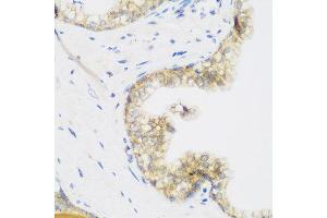 Immunohistochemistry of paraffin-embedded human prostate using KIAA1456 antibody at dilution of 1:200 (40x lens). (KIAA1456 antibody)