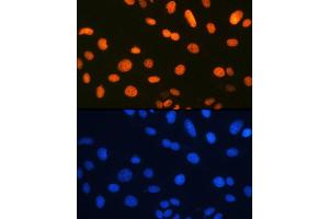 Immunofluorescence analysis of U-2 OS cells using Ku80 Rabbit mAb (ABIN7271406) at dilution of 1:100 (40x lens). (XRCC5 antibody)