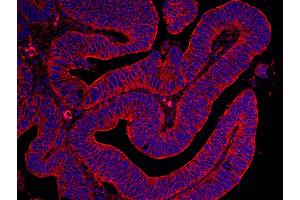 Immunohistochemistry (IHC) image for anti-Filamin B, beta (FLNB) (AA 2552-2602) antibody (ABIN7448565) (FLNB antibody  (AA 2552-2602))