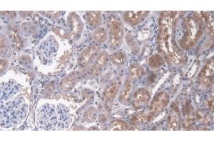 Detection of CD164 in Rat Kidney Tissue using Polyclonal Antibody to Cluster Of Differentiation 164 (CD164) (CD164 antibody  (AA 24-160))