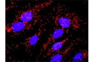 Proximity Ligation Analysis of protein-protein interactions between TP53 and BCR. (BCR antibody  (AA 182-280))