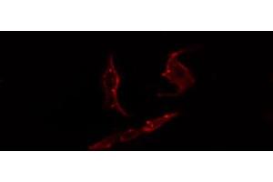 ABIN6274444 staining COLO205 cells by IF/ICC. (PARD3 antibody  (C-Term))