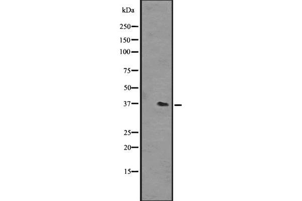 OR51L1 antibody  (Internal Region)