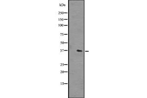 Western blot analysis of OR51L1 expression in NCI-H292 cell line lysates ,The lane on the left is treated with the antigen-specific peptide.