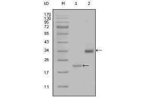 Western blot analysis using LPA mouse mAb against truncated LPA-His recombinant protein (1) and truncated Trx-LPA(aa4330-4521) recombinant protein (2).