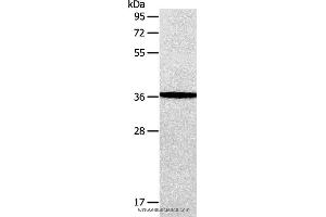Western blot analysis of Human fetal brain tissue, using AASDHPPT Polyclonal Antibody at dilution of 1:650