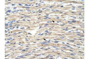 CARF antibody was used for immunohistochemistry at a concentration of 4-8 ug/ml to stain Skeletal muscle cells (arrows) in Human Muscle. (CDKN2AIP antibody  (C-Term))