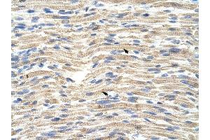 CARF antibody was used for immunohistochemistry at a concentration of 4-8 ug/ml to stain Skeletal muscle cells (arrows) in Human Muscle.