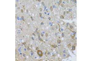 Immunohistochemistry of paraffin-embedded rat brain using DYNC1I1 antibody. (DYNC1I1 antibody)