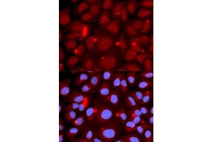 Immunofluorescence analysis of U2OS cell using PADI4 antibody. (PAD4 antibody  (AA 1-250))