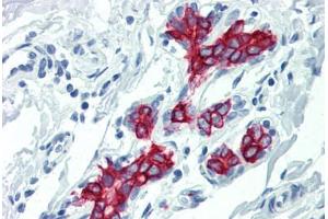 Human Breast (formalin-fixed, paraffin-embedded) stained with KRT19 antibody ABIN396943 at 10 ug/ml followed by biotinylated anti-mouse IgG secondary antibody ABIN481714, alkaline phosphatase-streptavidin and chromogen. (Cytokeratin 19 antibody)