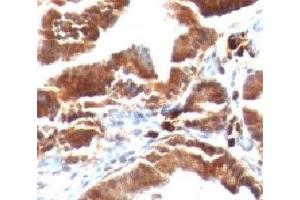 Formalin-fixed, paraffin-embedded human gallbladder stained with TOP1MT antibody (TOP1MT/488).