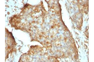 Immunohistochemistry (IHC) image for anti-beta-2-Microglobulin (B2M) antibody (ABIN6940415)