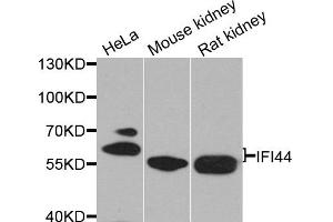 Western blot analysis of extracts of various cell lines, using IFI44 antibody.